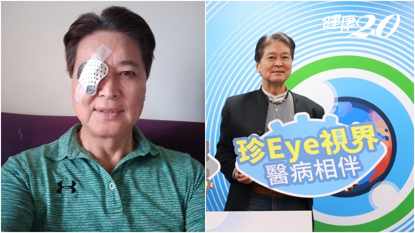 藝人劉尚謙青光眼未按時點藥左眼視力受損！以為近視度數加深 小心青光眼 