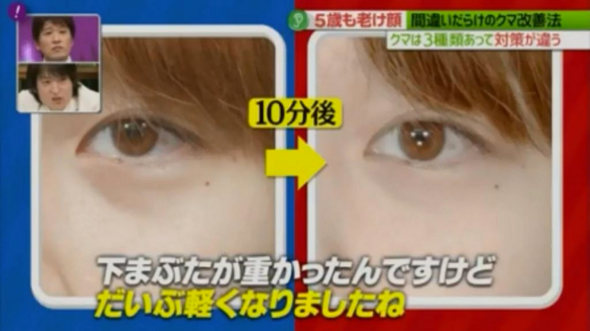 消除黑眼圈只要1條毛巾，10分鐘就搞定！日本醫美醫師秀除黑眼圈3絕招