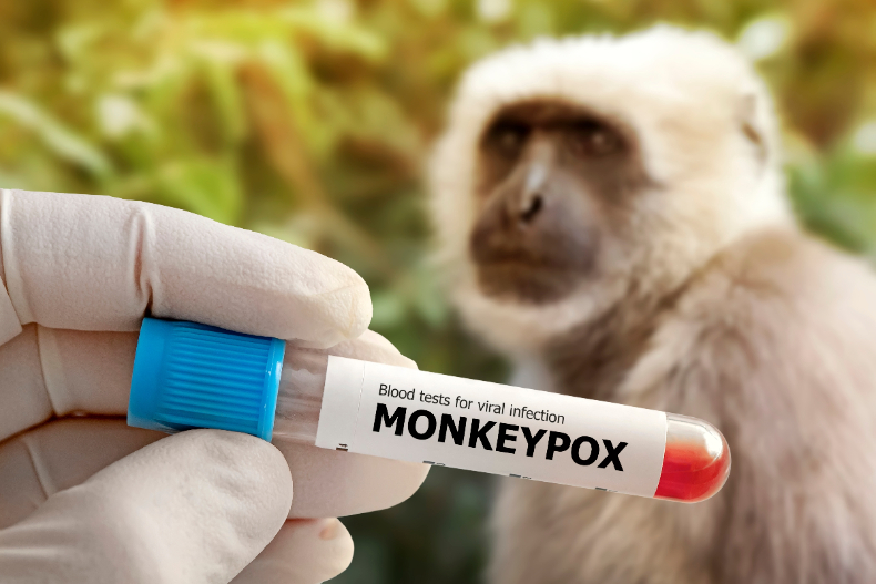 【猴痘20大必知懶人包】又新增12例！秒懂傳染途徑、如何預防、誰可接種疫苗、副作用