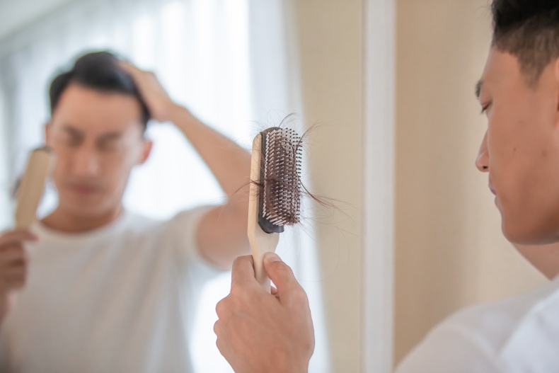 父親節給帥爸爸的頭髮保養指南！3植髮常見問題，解決落髮危機