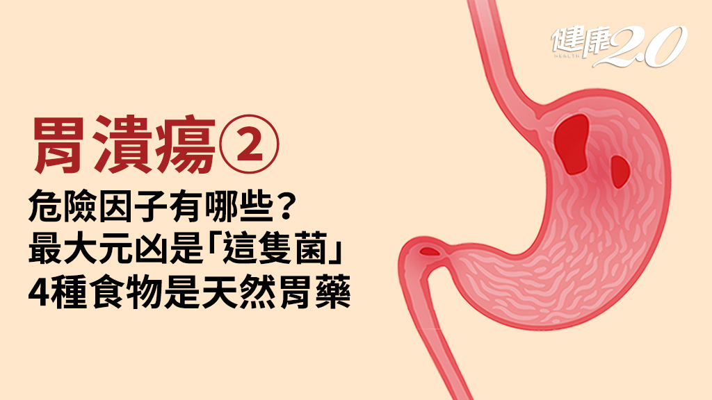 胃潰瘍／6種人容易得胃潰瘍 4方法揪出「潰瘍兇手」！多吃這些食物養胃