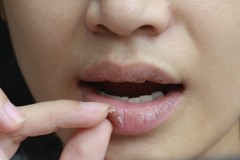 乾唇人必看！5個日常保養預防嘴唇乾裂死皮，護唇膏成分這樣挑才有效！