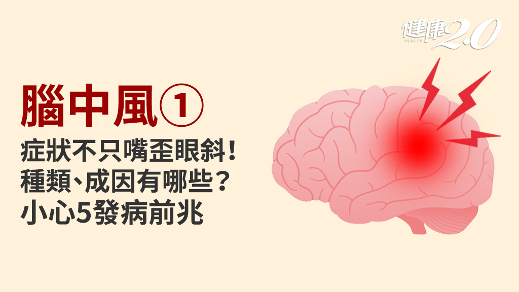 腦中風／不只嘴歪眼斜！腦中風症狀、成因有哪些？注意發病5徵兆