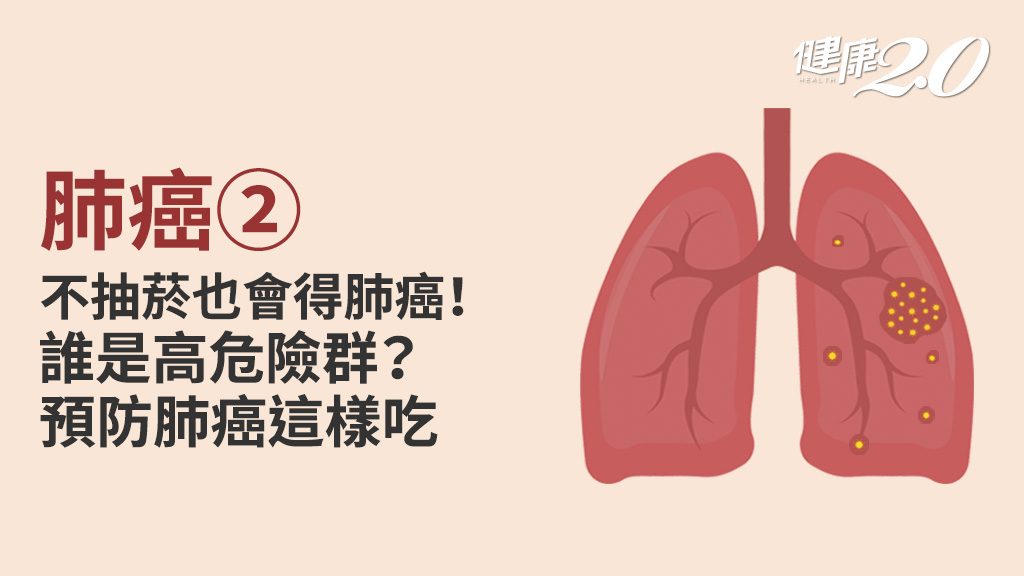 肺癌／哪些人容易得肺癌？顧肺必做5件事 4種超級營養素有效防肺癌