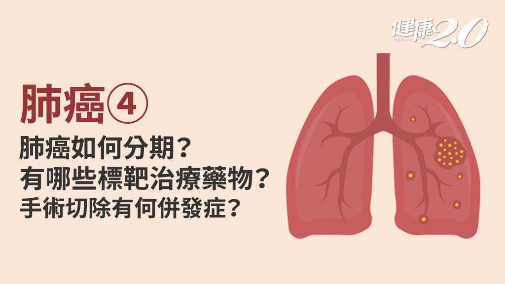 肺癌／確診肺癌如何治療？肺癌手術有哪些風險？哪些病人適合手術切除？