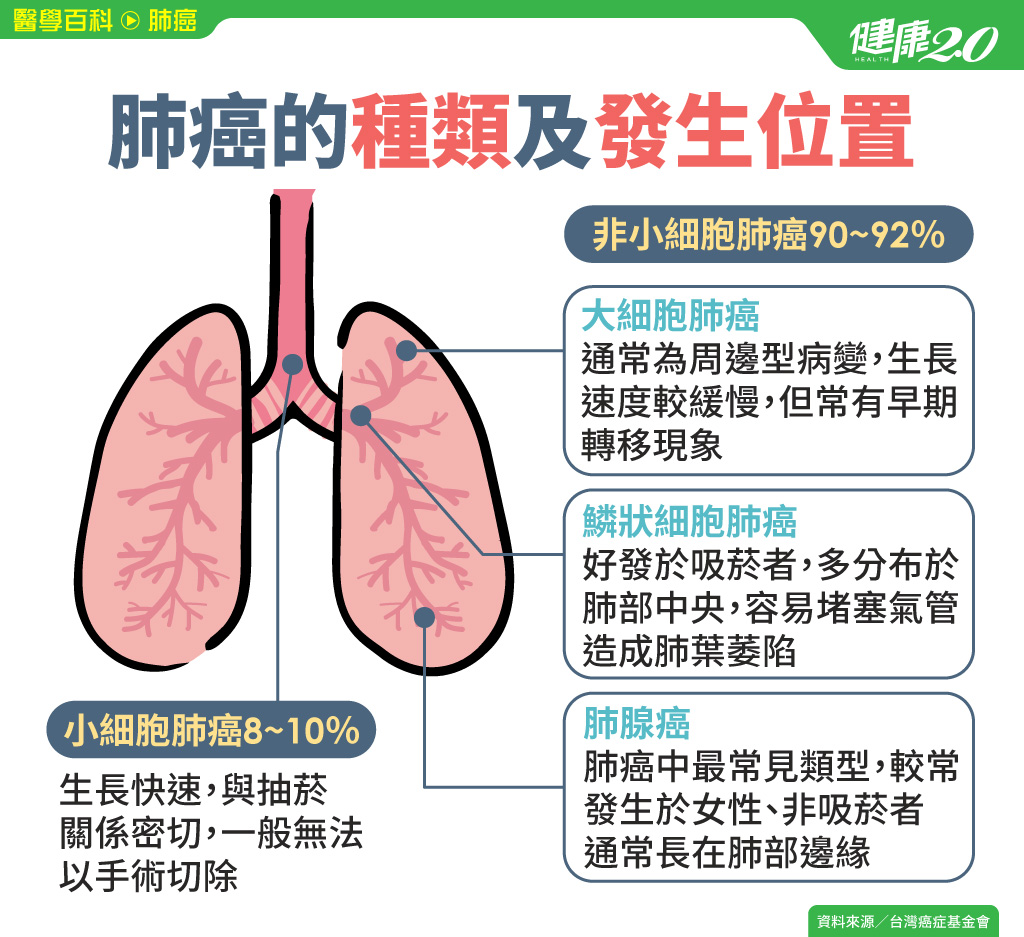 肺癌／肺部7個求救訊號！肺癌有哪幾種？這1種常發生在女性、非吸菸者