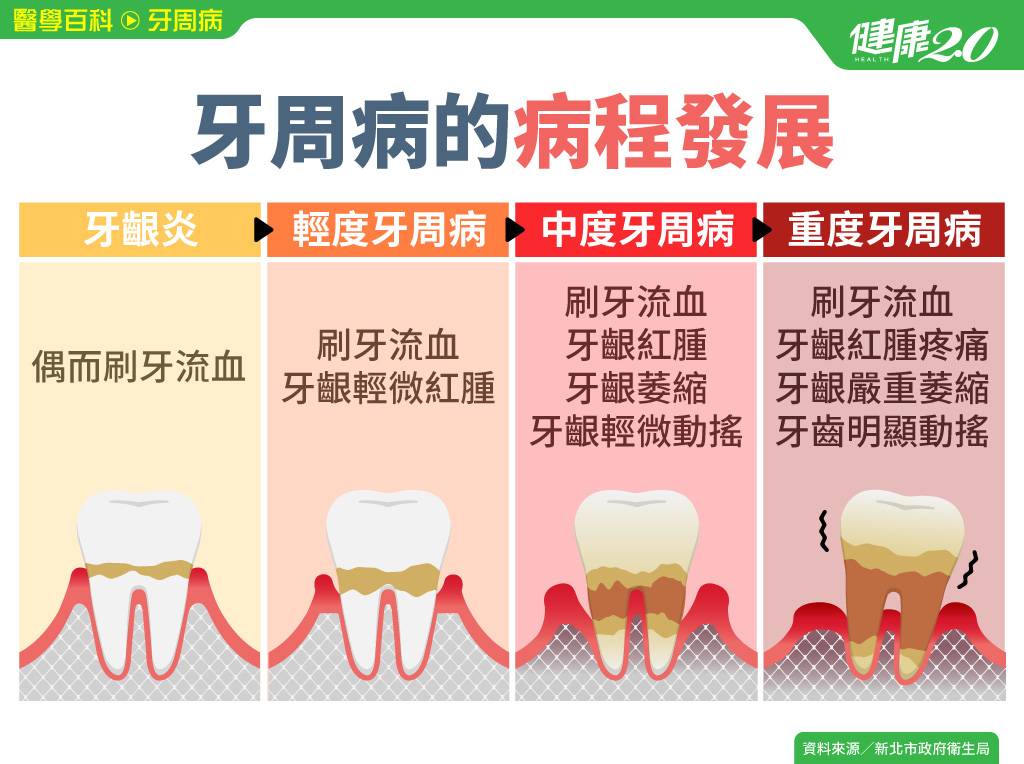 化学脳はどのくらい持続しますか?