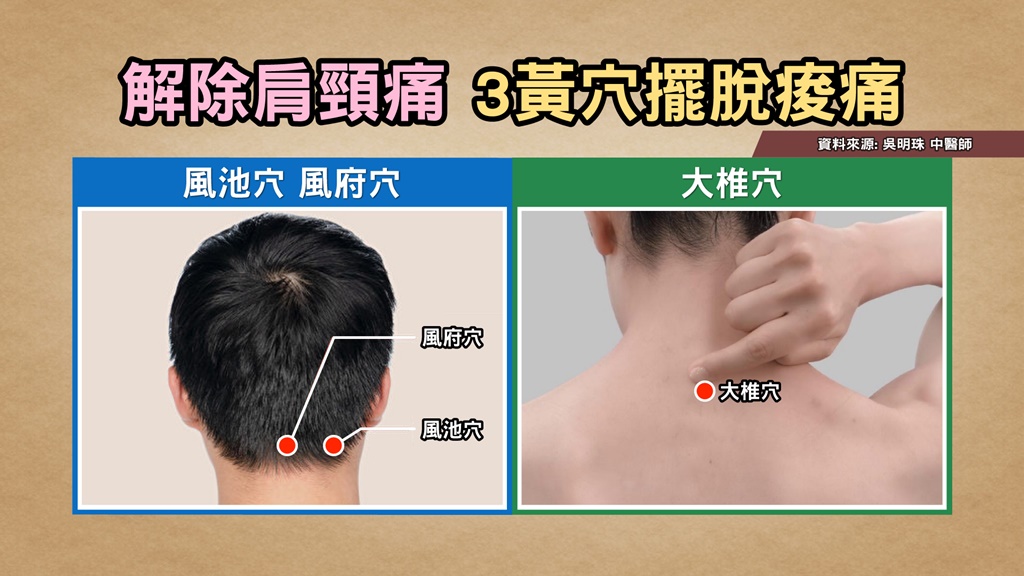 「落枕王」頸部痠痛更要動！頸部伸展+熱敷揉捏3穴 揮別肩頸硬梆梆