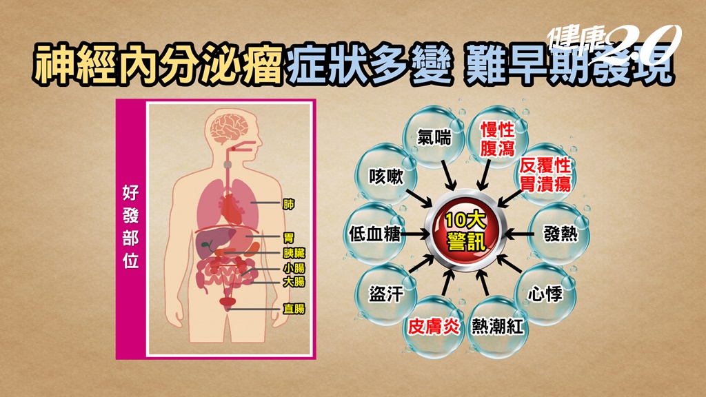 非外科的オプション