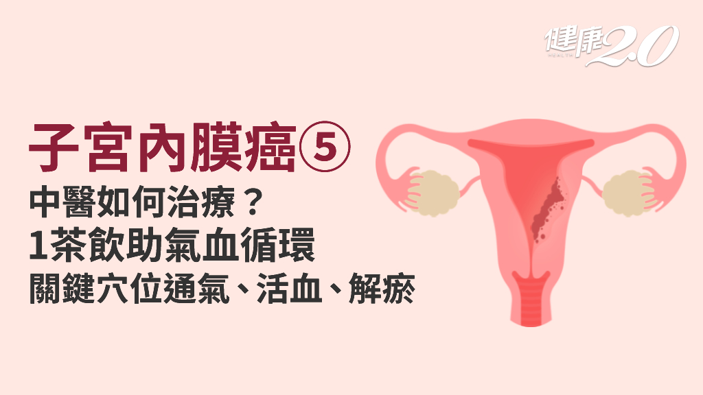 子宮內膜癌／1穴位＋1茶飲 中醫調合氣血穩定子宮內膜 推按這處保養子宮