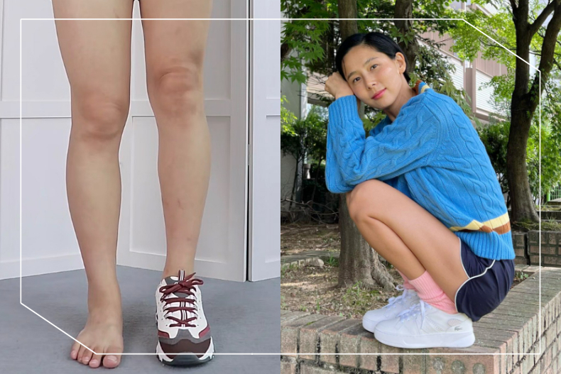 不用運動，腿也能變細！粗腿女生必學「球鞋穿搭法」，多1招蘿蔔腿也能細直美