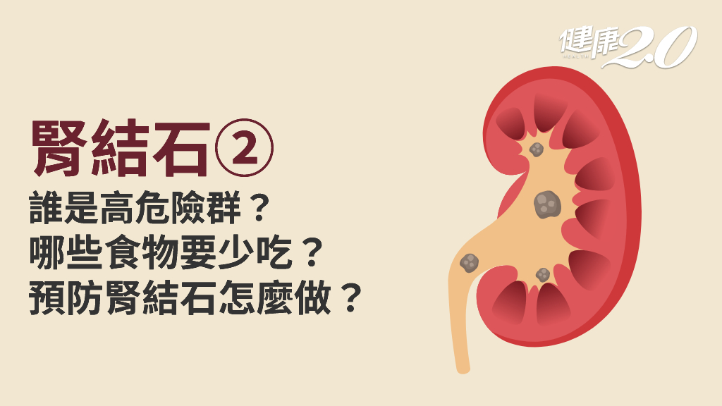 腎結石／9種人容易腎結石！常喝豆漿會導致腎結石嗎？如何預防腎結石？