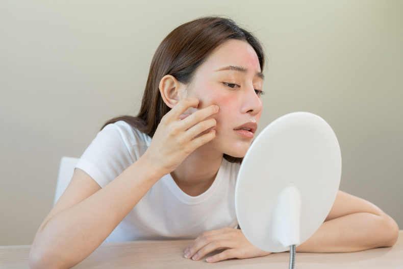 研究：68％的人第一條皺紋是夏天長出來的！「熱老化」曝曬10分鐘肌膚早衰10天