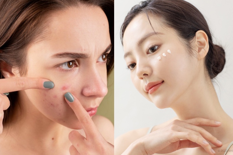 曬傷急救！韓國皮膚科醫師親授「曬後3天急救舒緩法」，只需「2產品」緩解紅燙肌膚
