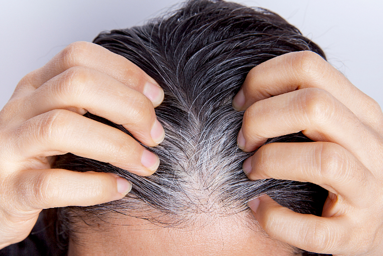 頭髮容易斷、白髮、掉髮，都是頭皮老化徵兆！比臉老得快6倍！頭皮基礎