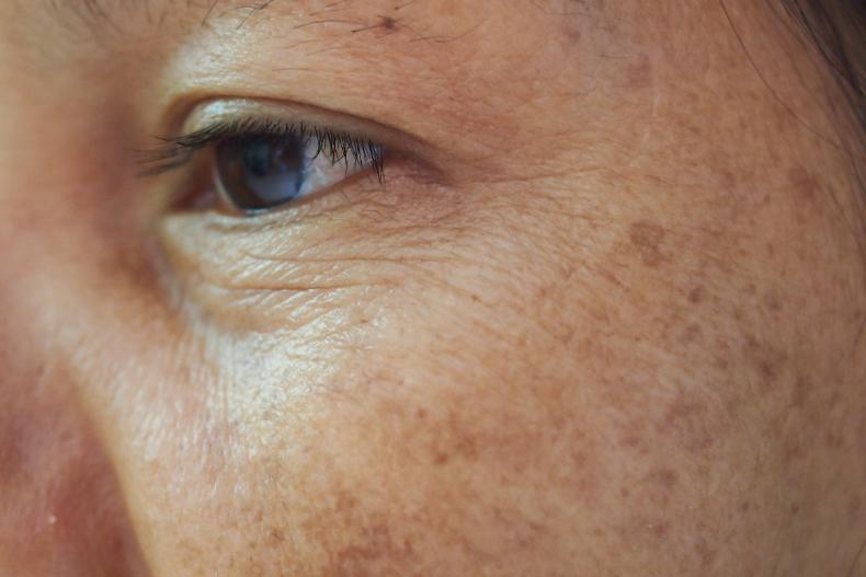 皮膚科醫師談肌膚老化，就是這4原因讓你變醜！抗老明星成分「菸鹼醯胺」不能不認識