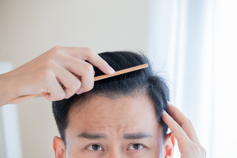 男女掉髮困擾大不同！解析性別掉髮6原因，減肥、綁頭髮、過勞都上榜