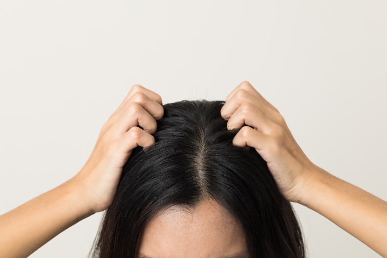髮粉會傷害頭皮嗎？盤點髮際線粉優缺點、副作用、注意事項，使用不當恐掉更多頭髮
