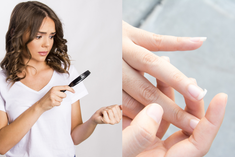 從指甲看5個身體健身警訊:指甲凹陷、容易斷、白斑⋯改善訣竅公開