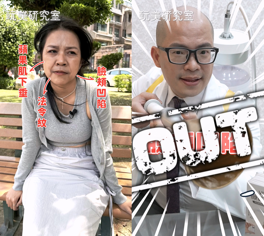 拍照「死亡角度」也不怕！韓國爆紅VIVABELLA薇貝拉魔法針，撫平凹陷美貌翻倍！