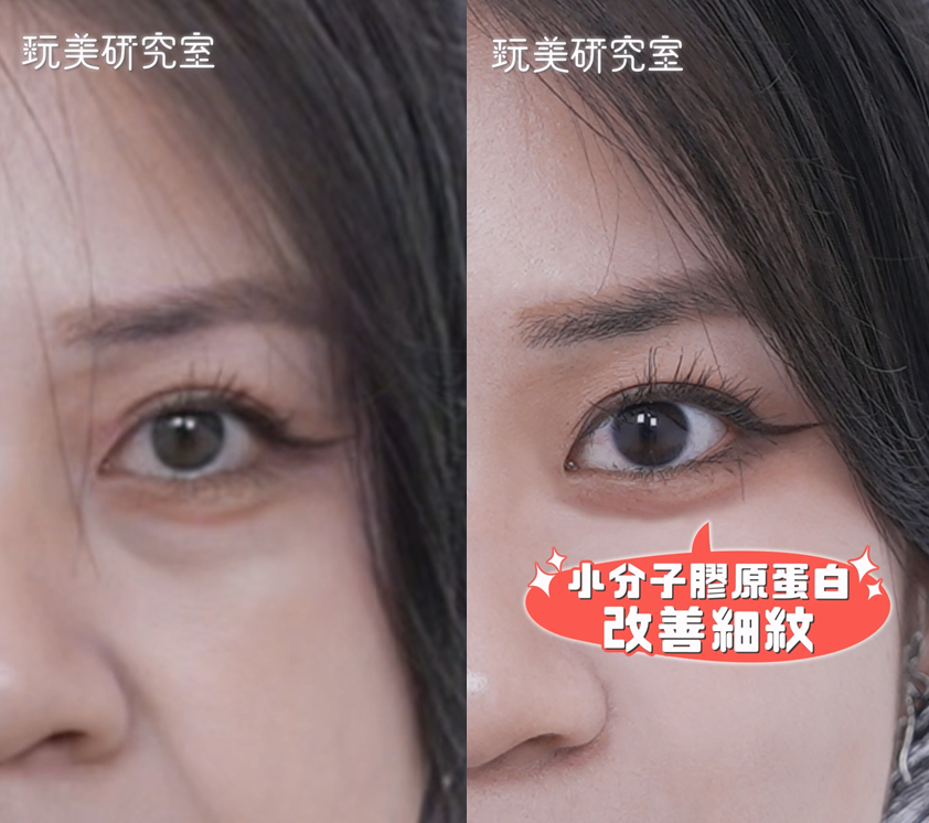 拍照「死亡角度」也不怕！韓國爆紅VIVABELLA薇貝拉魔法針，撫平凹陷美貌翻倍！