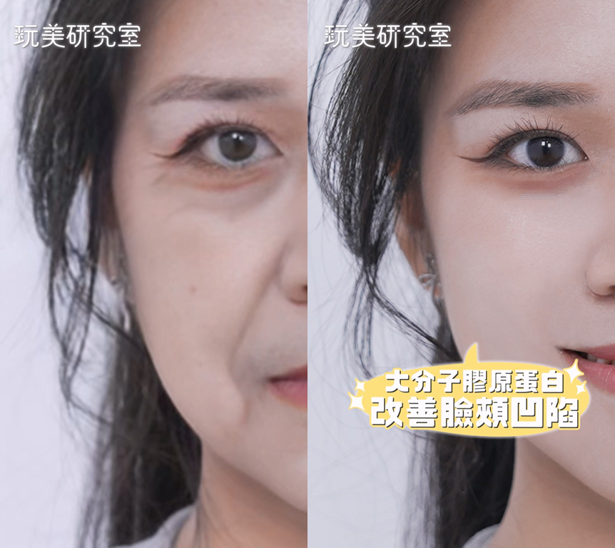 拍照「死亡角度」也不怕！韓國爆紅VIVABELLA薇貝拉魔法針，撫平凹陷美貌翻倍！