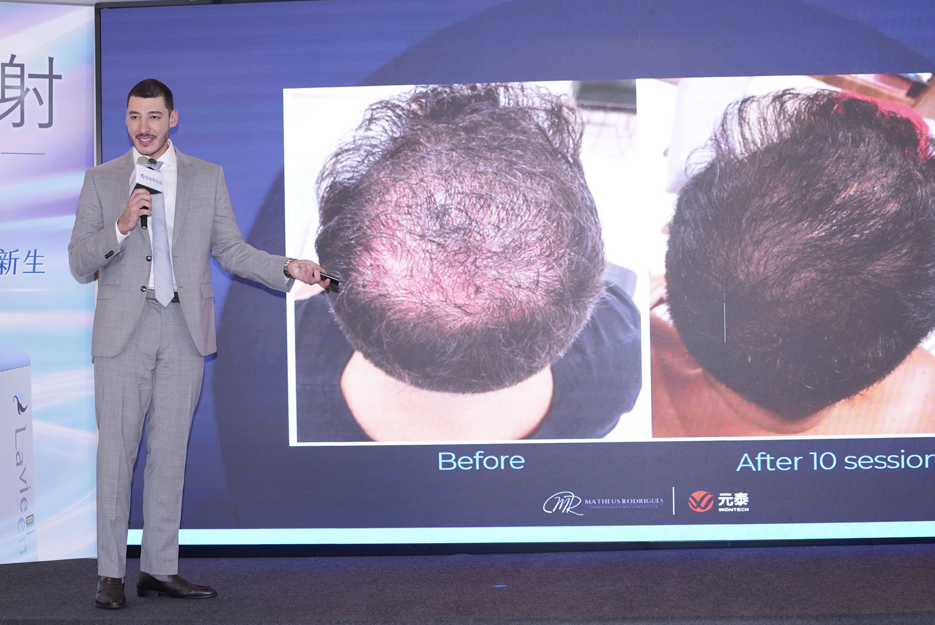 「髮」現新生力!愛爾麗引進拉髮密雷射 吳依霖親證喚醒沉睡毛囊