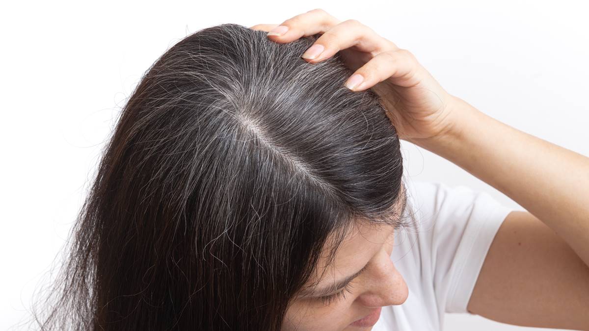 白頭髮可以黑回來嗎？越拔會越多根？專家給答案：把握時機有望重獲黑髮