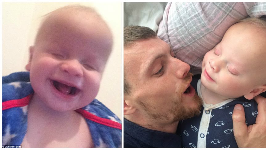 英國一名無眼珠男嬰，以笑臉對抗生命逆境。（圖取自／每日郵報）