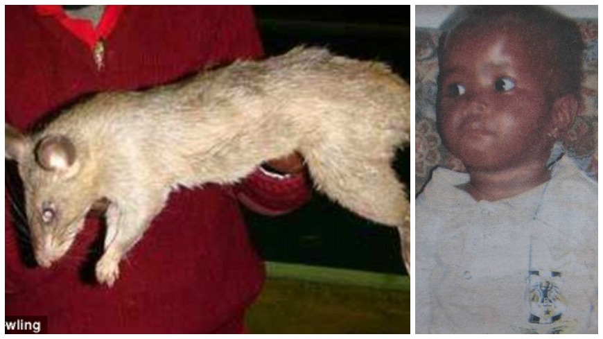 南非巨鼠、該名受害女童（翻攝／dailymail）