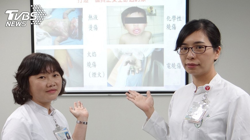 兒童燒燙傷 近9成在家中
