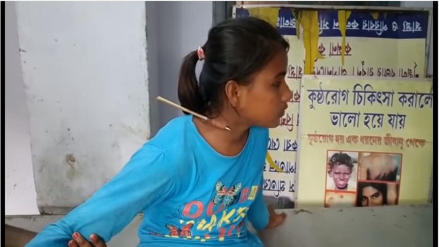 印度一名少女脖子遭利箭射穿，但幸運撿回一命。(圖／翻攝自YouTube)