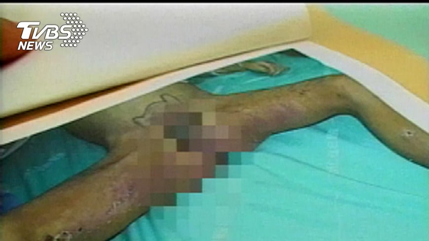 桃園一名3歲男童遭虐待致死，全身遭針扎還刺青。(圖／TVBS資料畫面)