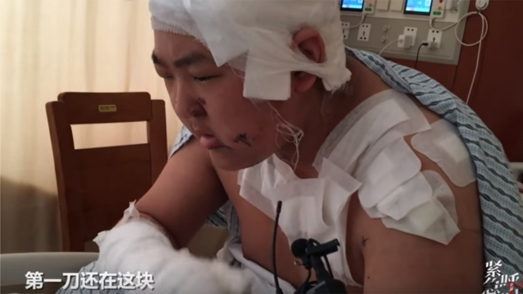 王姓學生頭部、嘴巴和胸口多處刀傷，且眼球破裂，雙眼幾乎失明。圖／翻攝自YouTube
