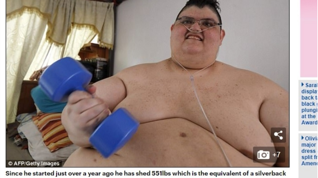 「地表最胖男」1年內狂甩250公斤。圖／英國每日郵報。