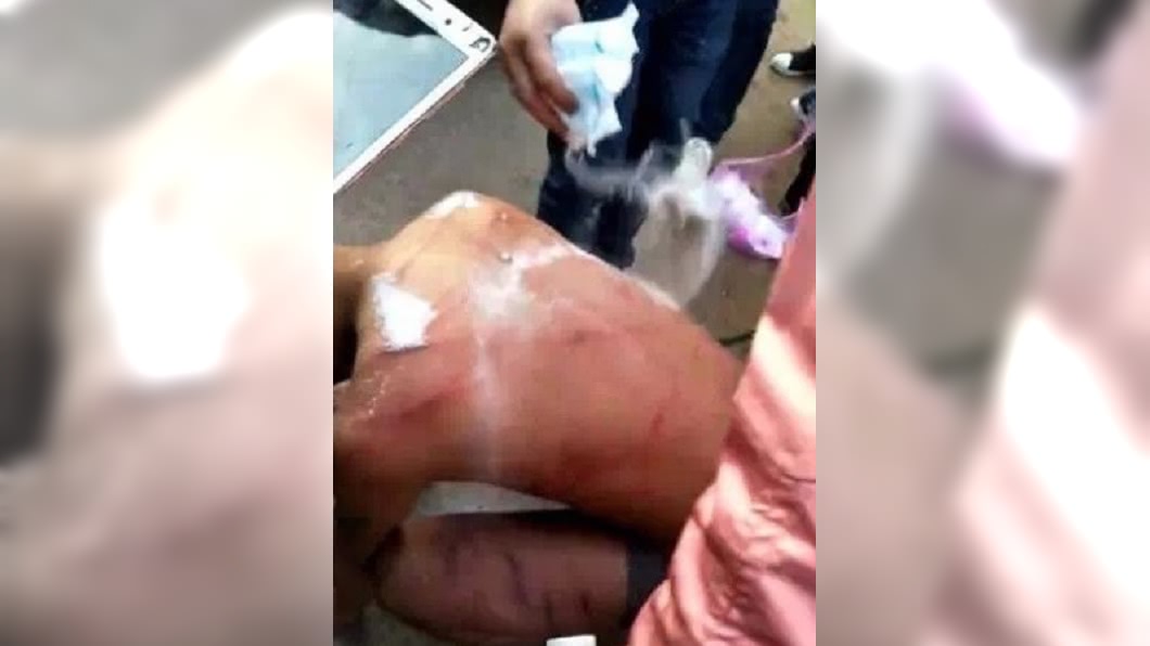 大陸一名新郎遭「鞭刑」鬧婚,當場皮開肉綻。圖/翻攝自微博