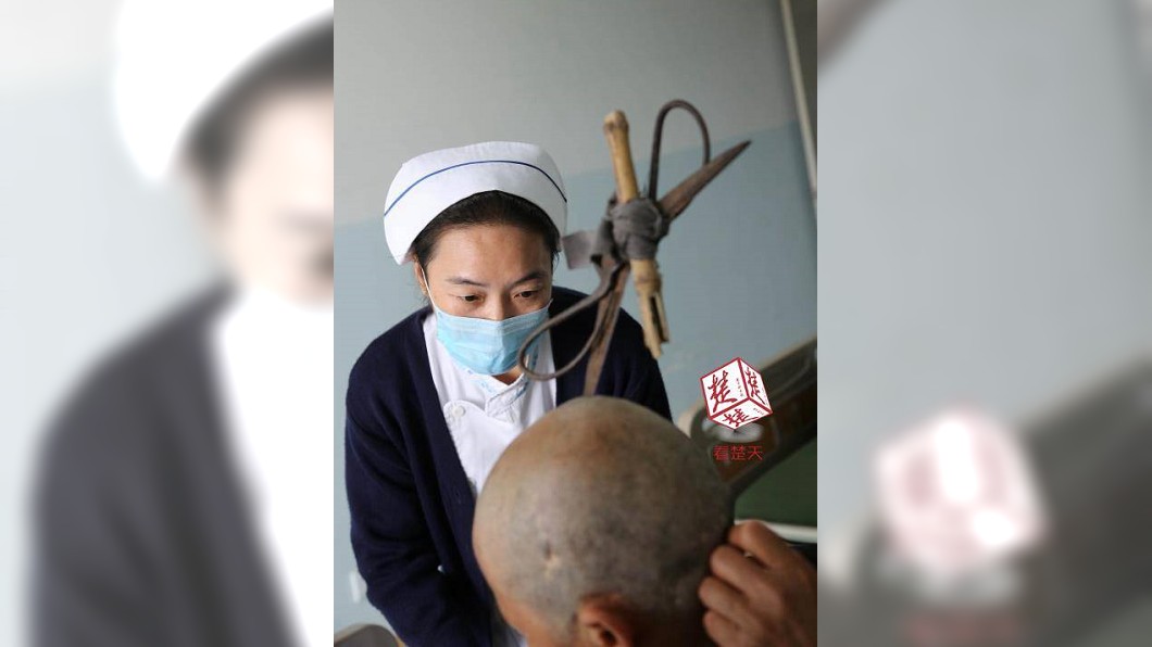 一名婦人遭剪刀插入頭部後，搭1小時公車就醫。圖／翻攝自《楚天都市報》