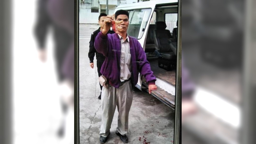 紫衣男被砍斷4根指頭,竟神色淡定似沒受傷一樣。圖/翻攝自kdslife