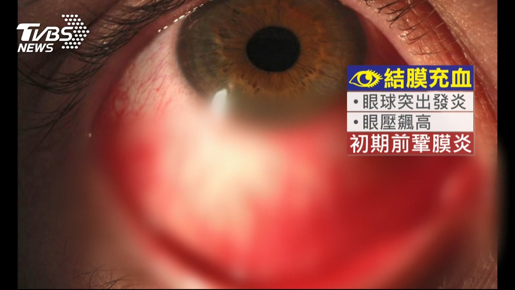 圖／TVBS