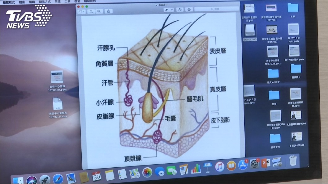 家屬控缺麻醉師 衛生局:「局部麻醉」不需