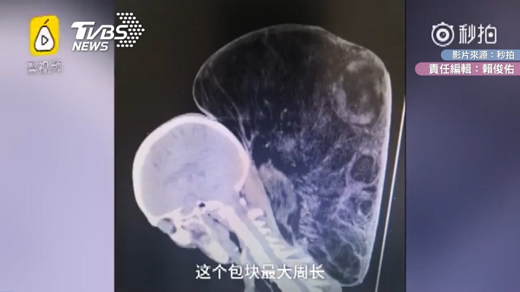 圖/翻攝自 秒拍