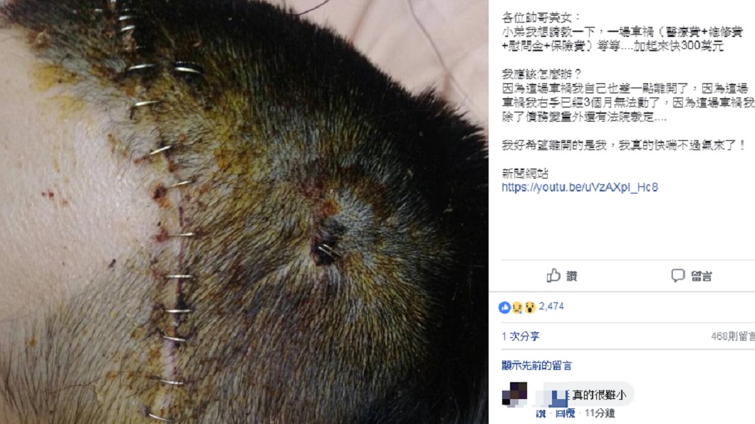 陳姓網友因當時的車禍,也受了重傷。圖/翻攝爆廢公社