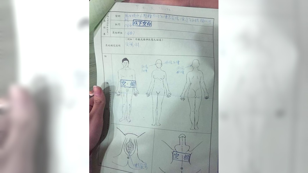 小花下體也有撕裂傷痕跡,但因為性侵的男子有戴保險套,且事發已過了一天,所以並未採集到體液。圖/翻攝臉書