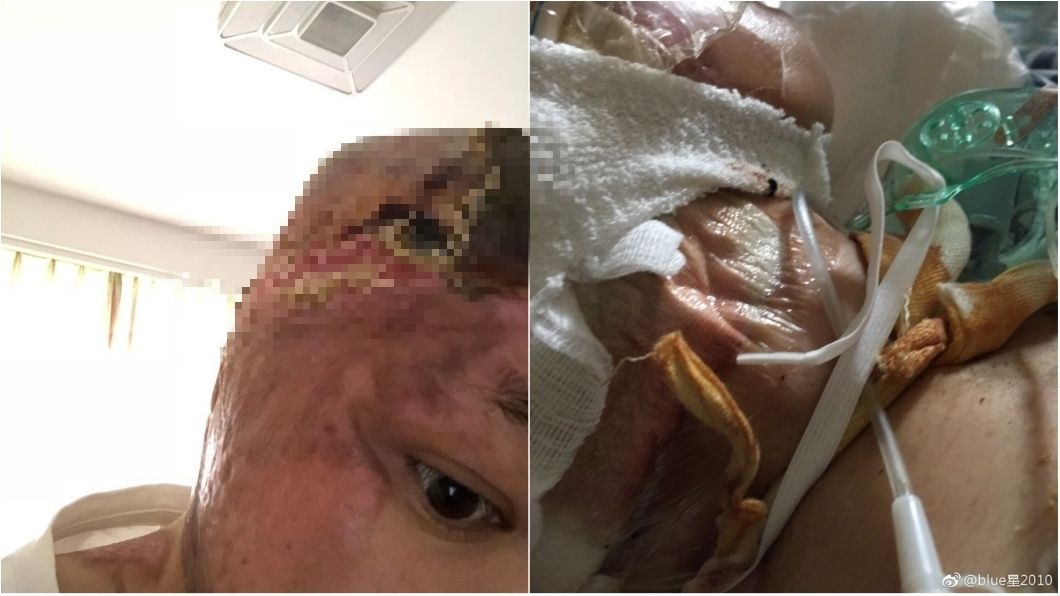 藍星表示自己燒炭輕生後,沒死成反而重傷進ICU,不料丈夫卻和小三跑去拍婚紗。圖/翻攝自《微博》