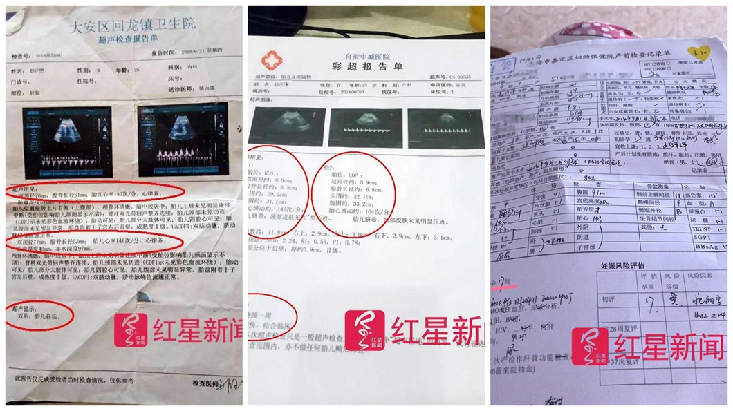 夫妻倆秀出先前的產檢報告,資料和超音波都顯示是雙胞胎。(圖/翻攝自紅星新聞)