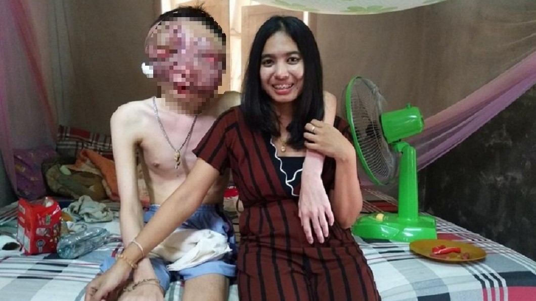 泰國21歲男子罹患網膜母細胞瘤，五官變形，影響視力聽力。圖／翻攝自 臉書