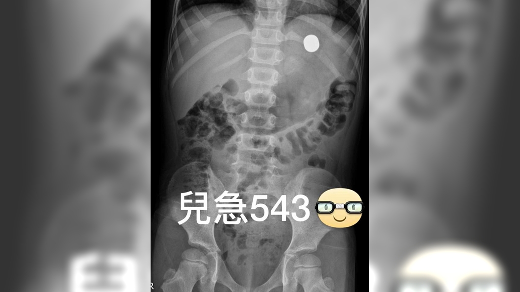 圖／翻攝自來講兒科急診的543-吳昌騰醫師臉書