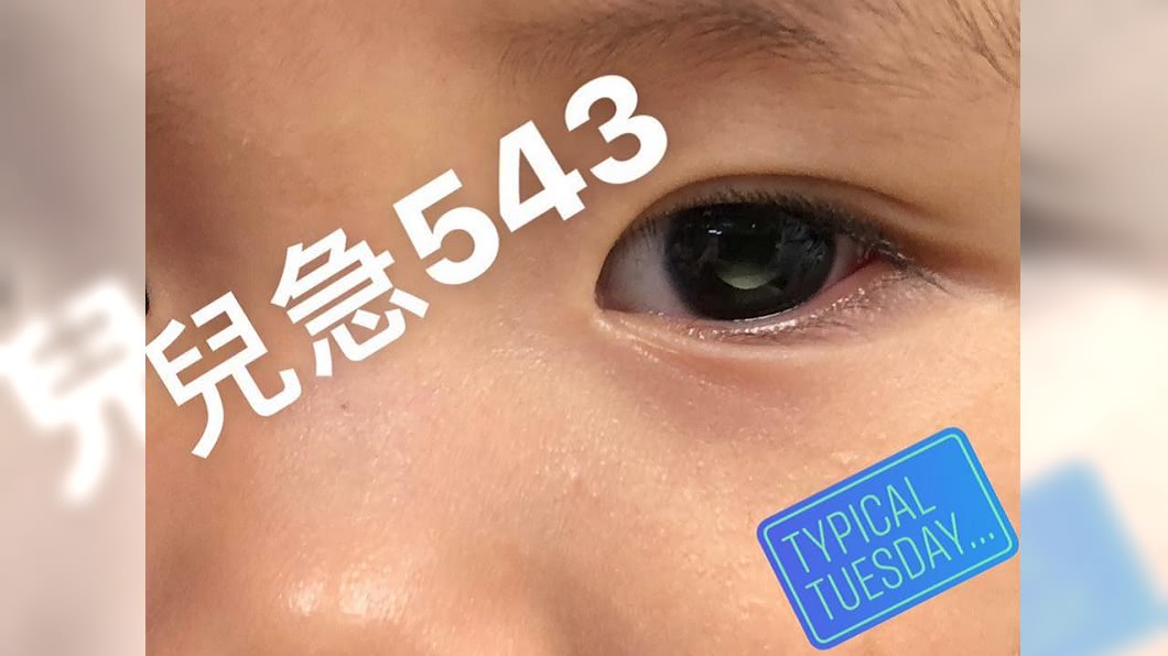 京都同仁堂 3歲女童眼中有白點…以為眼睛髒 檢查發現是眼癌