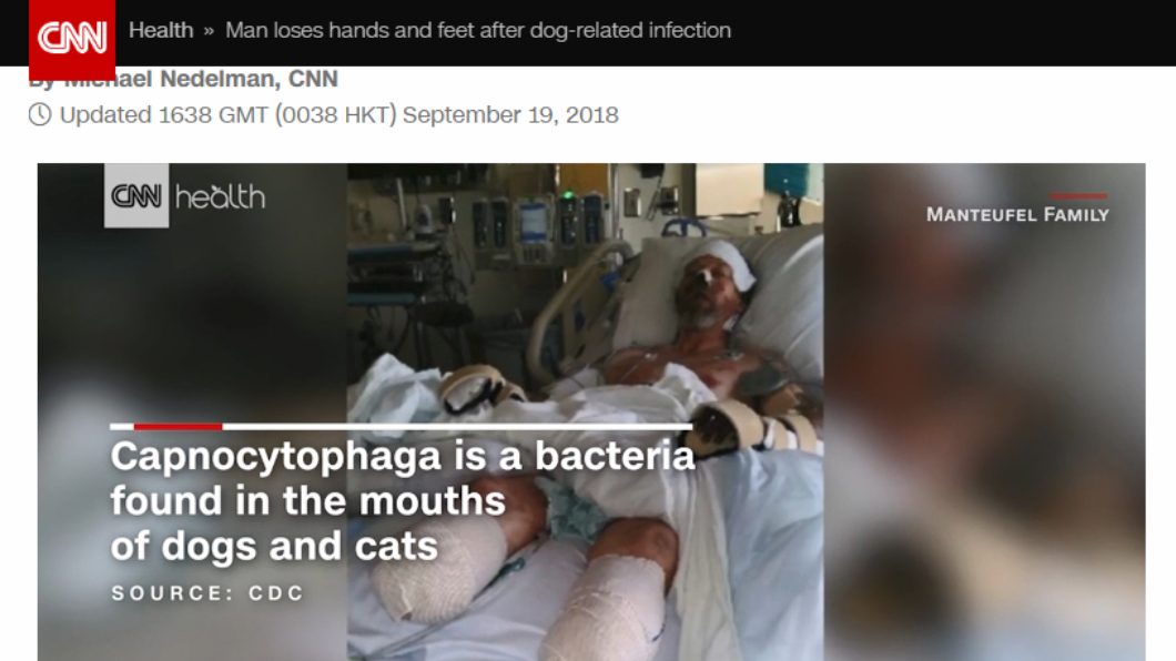 桂格曼塔斐因受到愛犬口水感染，必須切除四肢。圖／截自CNN