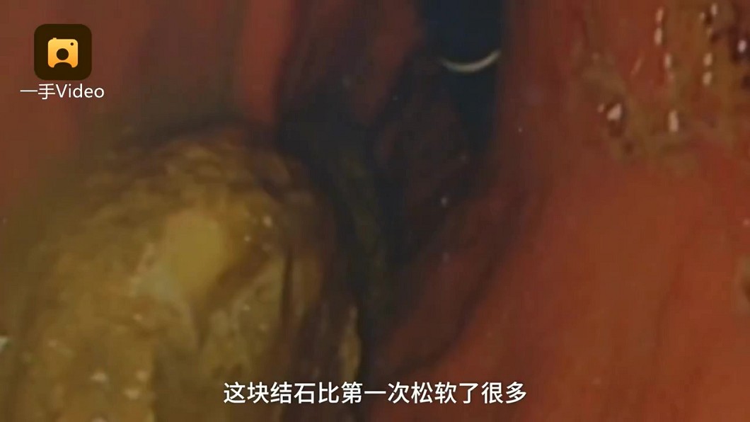 圖/翻攝梨視頻